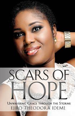 Picture of Scars of Hope