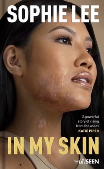 Picture of In My Skin